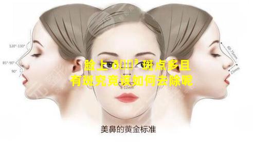 脸上 🌳 斑点多且有斑究竟该如何去除呢